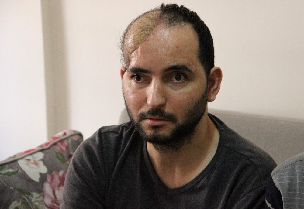 Kahraman Gazi, Türkiye’de ilk kez yapılan yöntemle sağlığına kavuştu